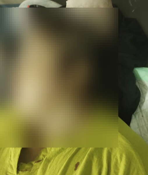 Misnawati korban pembacokan oleh S, menantunya.(ist : Satreskrim Polres Barito Utara) 